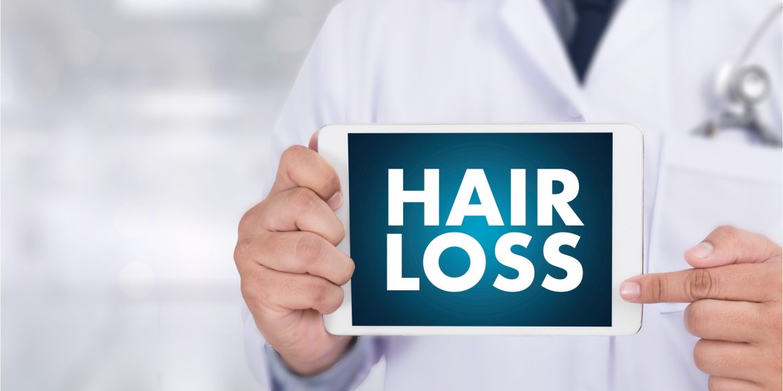 Weblog: Male Sample Hair Loss