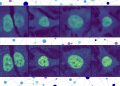 With AI, researchers predict the situation of nearly any protein inside a human cell | MIT Information